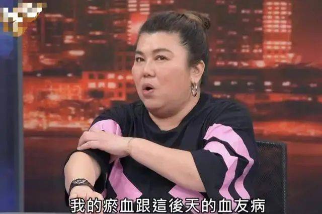 57岁的中国台湾女演员林美秀自曝患上罕见疾病血友病，甚至已经开始为自己的后事做打算(图1)